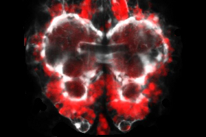 Tribolium castaneum brain