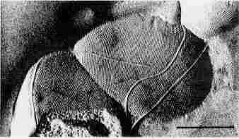 Figure Methanobacterium