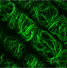 Fimbrin-GFP